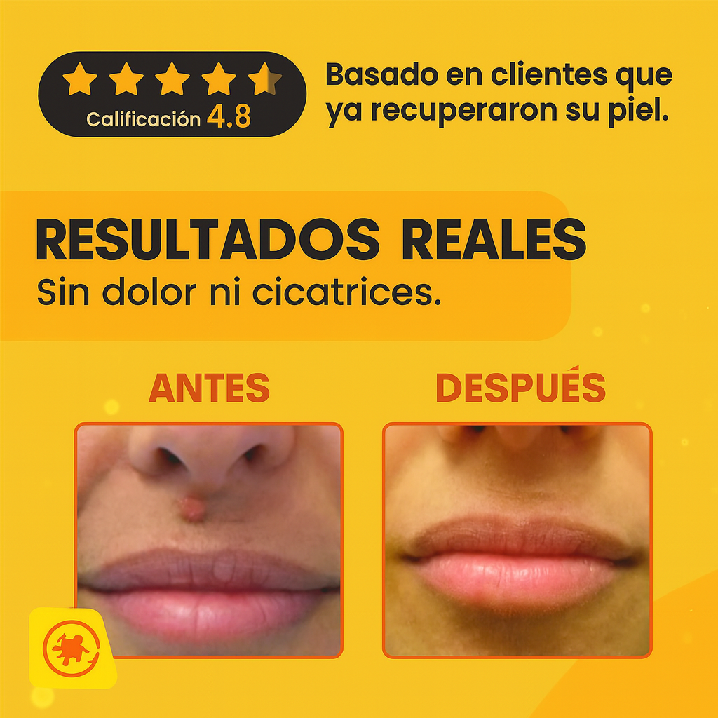 🧘♀️ Recupera tu piel: Tag Recede y dí adiós verrugas y manchas, confianza en 1 spray.