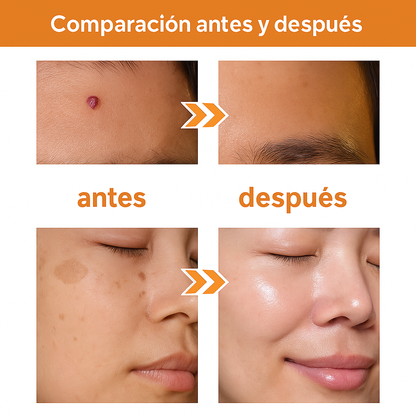 🧘‍♀️ Recupera tu piel: Tag Recede y dí adiós verrugas y manchas, confianza en 1 spray.
