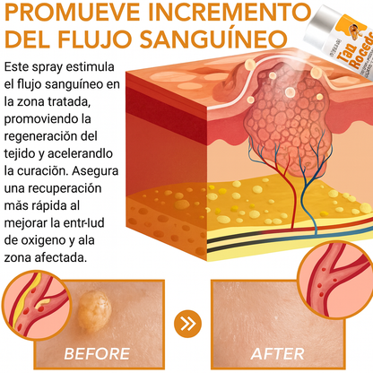 🧘‍♀️ Recupera tu piel: Tag Recede y dí adiós verrugas y manchas, confianza en 1 spray.