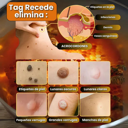 🧘‍♀️ Recupera tu piel: Tag Recede y dí adiós verrugas y manchas, confianza en 1 spray.