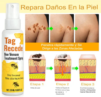 🧘‍♀️ Recupera tu piel: Tag Recede y dí adiós verrugas y manchas, confianza en 1 spray.